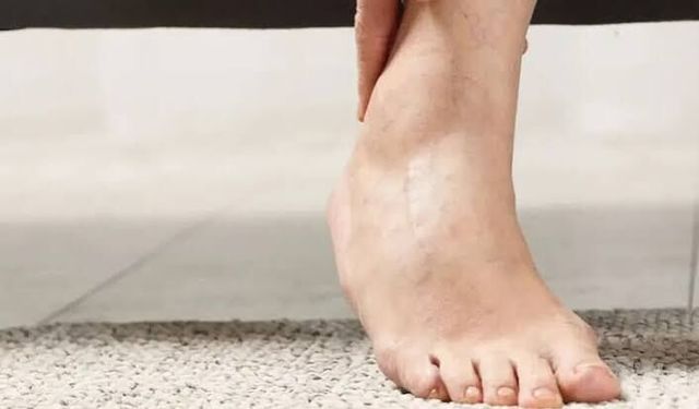 Nefes Darlığı ve Bacak Şişliği Kalp Yetersizliği İşareti Olabilir