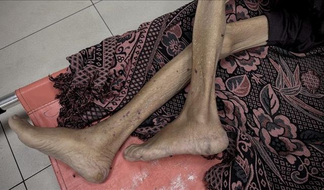 Gazze'de 3'ü çocuk 10 kişi daha açlıktan hayatını kaybetti
