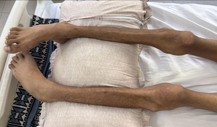 Gazze'de son 24 saatte 2 kişi daha açlıktan hayatını kaybetti